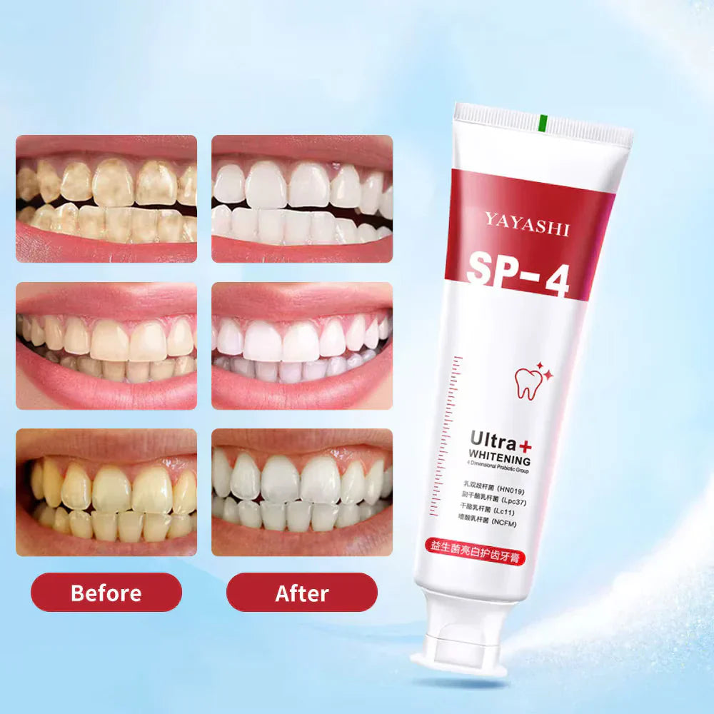 Yayashi SP4 Probiotic Whitening Toothpaste 120g – Removes Coffee, Tea & Smoking Stains + Free Delivery!