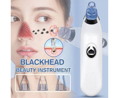 Blackhead Suction Remover & Pore Vacuum | Ultimate Beauty Tool for Deep Pore Cleaning | Cell Operated