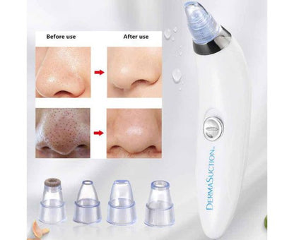 Blackhead Suction Remover & Pore Vacuum | Ultimate Beauty Tool for Deep Pore Cleaning | Cell Operated