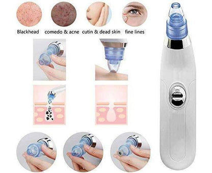 Blackhead Suction Remover & Pore Vacuum | Ultimate Beauty Tool for Deep Pore Cleaning | Cell Operated